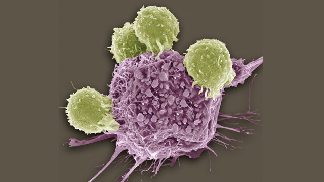 T cells killing cancer cell